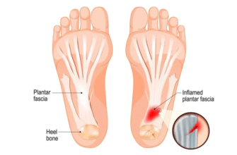 Пекучий біль у верхній частині стопи: причини та лікування