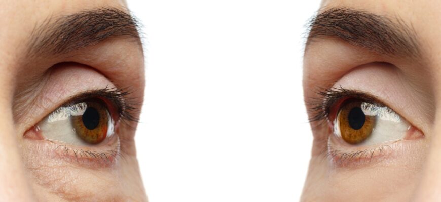 Післяопераційний догляд та відновлення після відшарування сітківки ока