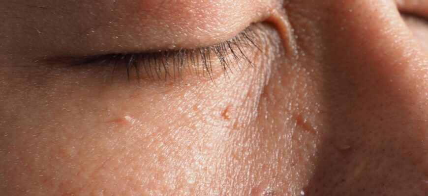 Післявидалення бородавки: можливі наслідки та як їх уникнути