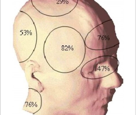Посттравматичний головний біль: причини, симптоми та методи лікування