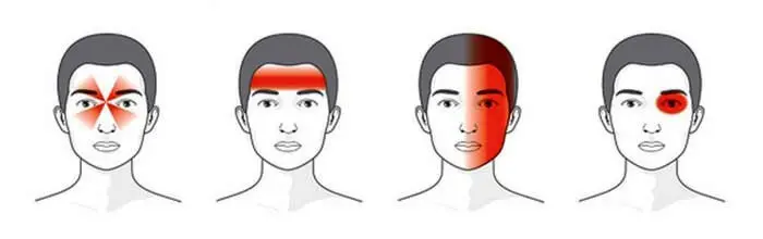 Лікування головного болю в Києві — діагностика та терапія у ...