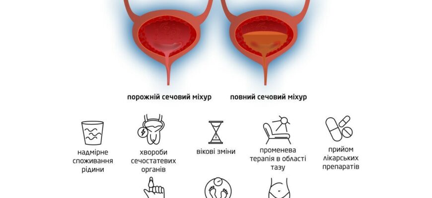 Проблема підтікання сечі після сечовипускання у чоловіків: причини та рішення