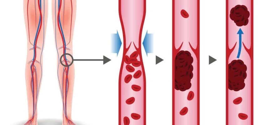Причини болю в м’язах ніг: основні фактори та методи усунення
