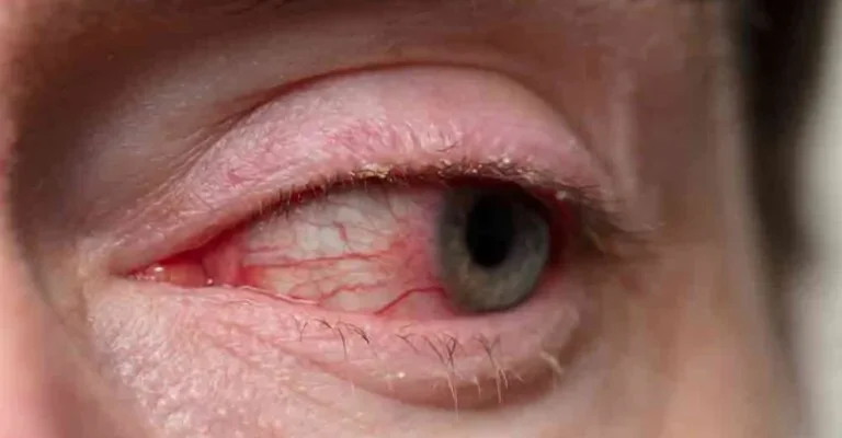 Причини болю в очах: основні фактори та рекомендації для полегшення