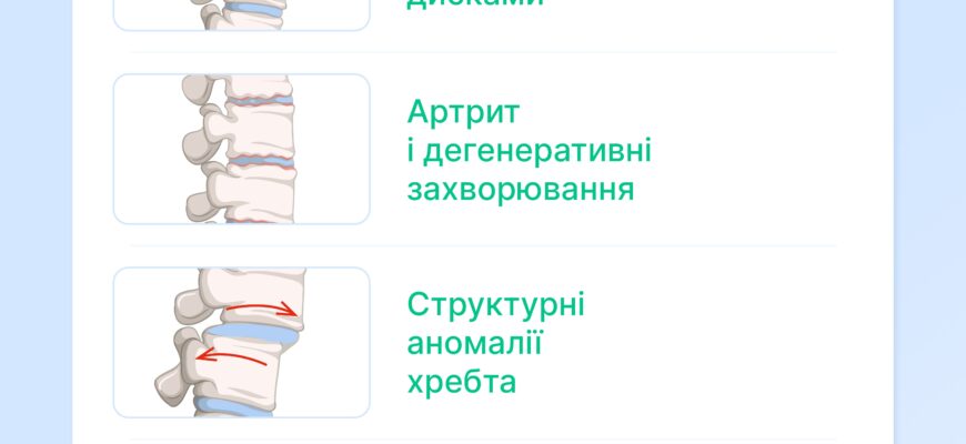Причини болю в попереку: основні фактори та методи діагностики