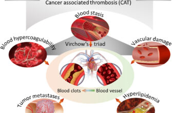 Причини підвищення температури після хіміотерапії: що варто знати?