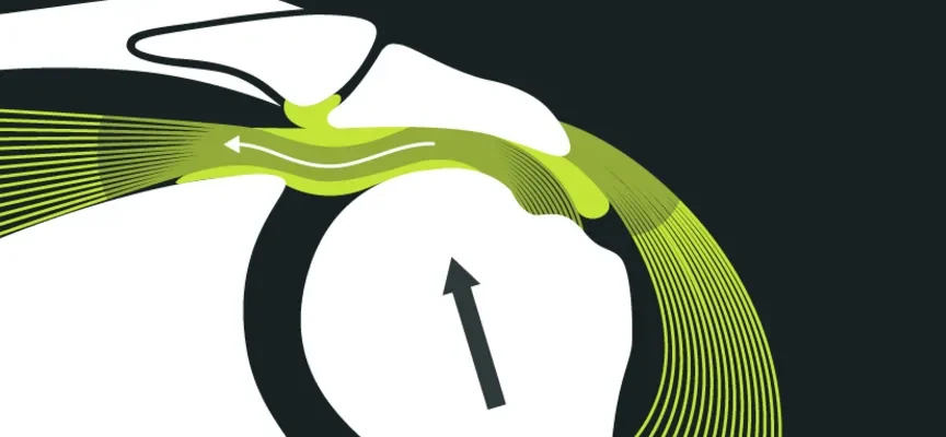 Причини, симптоми та лікування болю у правому плечі: повний гайд