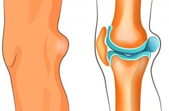 Причини та лікування болю під коліном спереду: поради лікарів