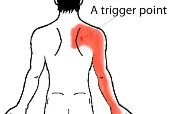 Причини та лікування болю під лівою лопаткою, що віддає в руку