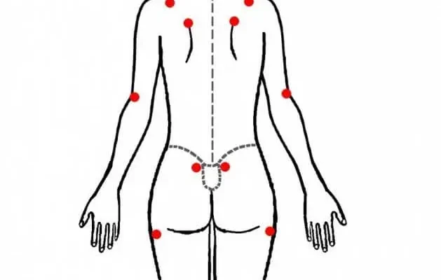 Причини та лікування болю під лівою лопаткою ззаду: що важливо знати