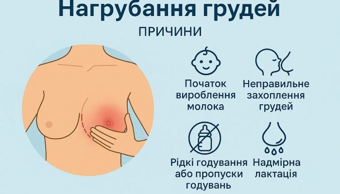 Причини та лікування болю під правою груддю: що потрібно знати