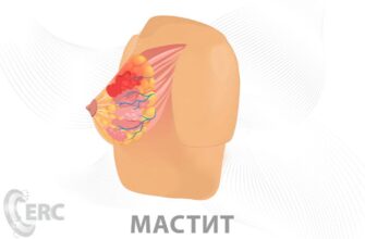 Причини та лікування болю в грудях у жінок: що потрібно знати