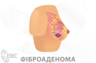 Причини та лікування болю в яєчках: що потрібно знати чоловікам