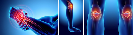 Біль у суглобах: причини, профілактика та лікування - НІКОМЕД ...