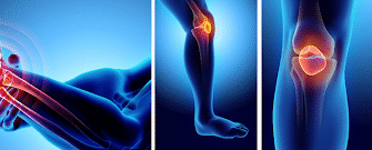 Причини та лікування болю в кістках: як позбутися неприємних відчуттів