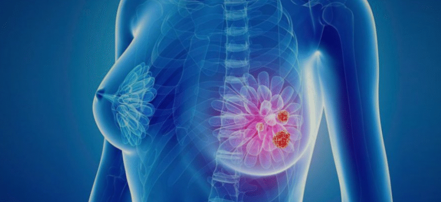 Причини та лікування болю в молочних залозах: поради експертів