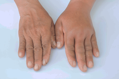 Біль в лікті - причини та варіанти лікування | МЦ ЖИТТЯ