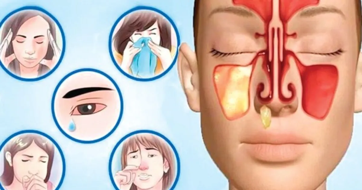 Сім видів головного болю: чим відрізняються і як позбутися ...