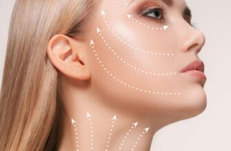 Причини та лікування набряку повік після ботоксу: поради експертів