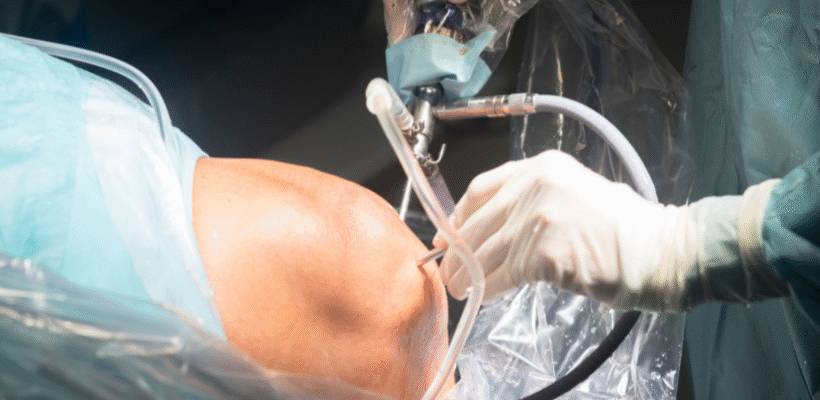 Причини та методи лікування набряку коліна після артроскопії