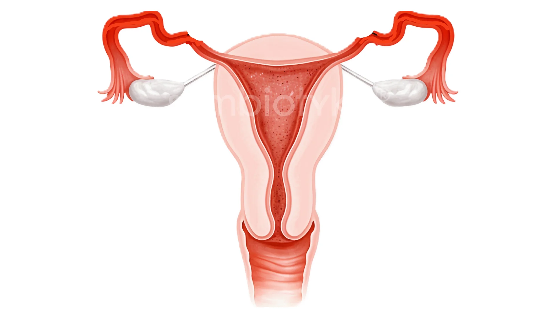 Сальпінгіт: причини, симптоми, діагностика та сучасні методи лікування