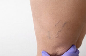 Причини та способи лікування болю в ногах нижче колін: повний гайд