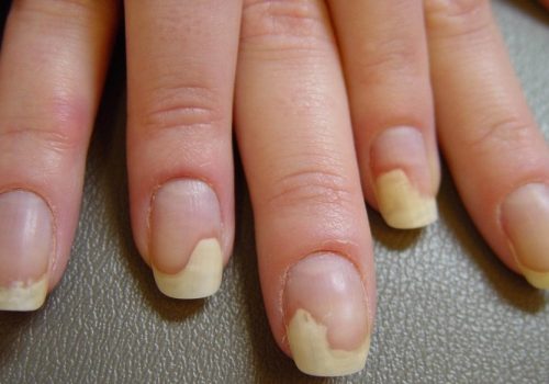 Причини та вирішення проблеми пустоти під нігтем після гель-лаку