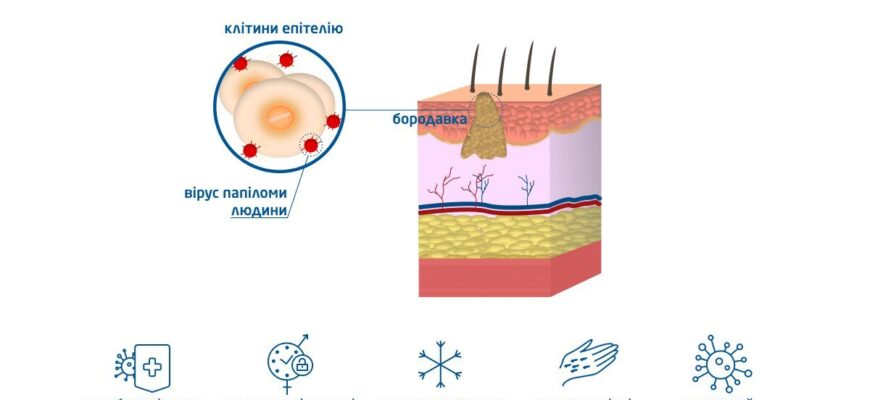 Пухирі після видалення бородавок азотом: причини, догляд й поради