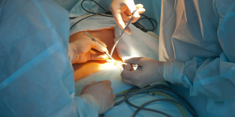 Раціон харчування: що можна їсти після видалення жовчного міхура?