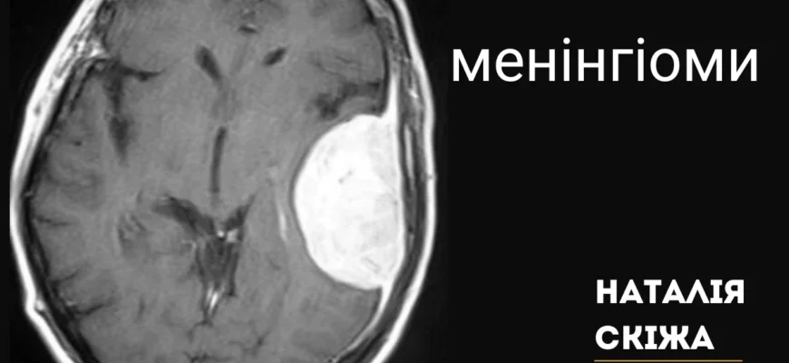 Реабілітація після видалення менінгіоми: ключ до швидкого одужання