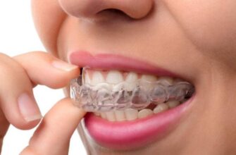 Ретейнери після брекетів: Чому вони необхідні для ідеальної усмішки
