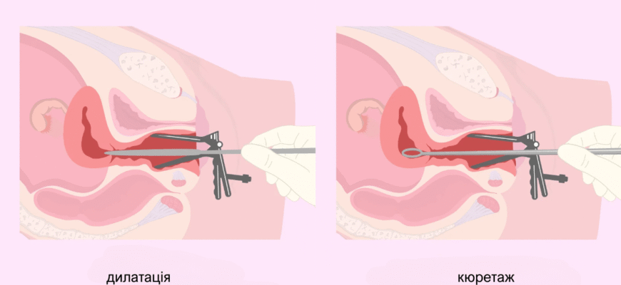 Ріжучий біль у вагіні: причини, симптоми та методи лікування