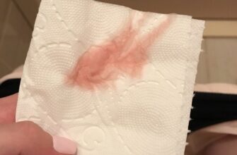 Рожеві виділення і біль внизу живота: причини та діагностика симптомів