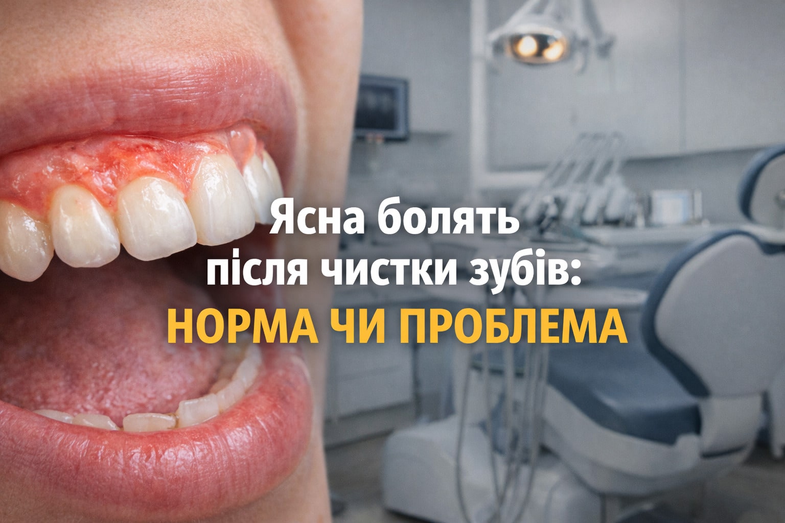 Ясна болять після чистки зубів: норма чи проблема | SM Clinic Київ