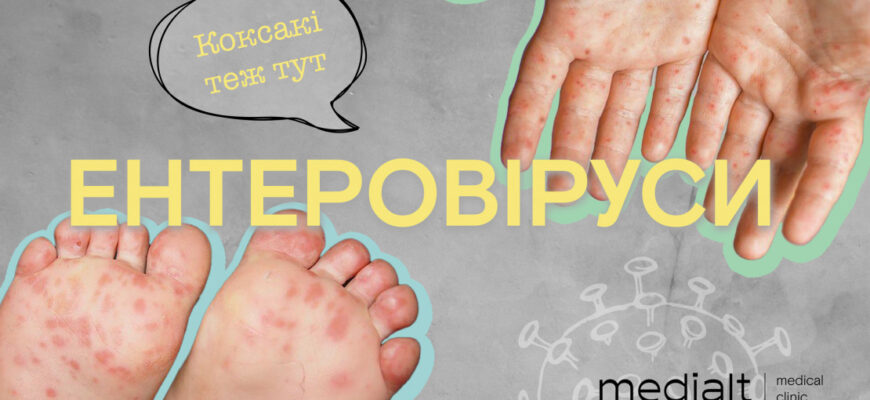 Що робити, якщо дитину турбує нічний біль в ногах: поради батькам