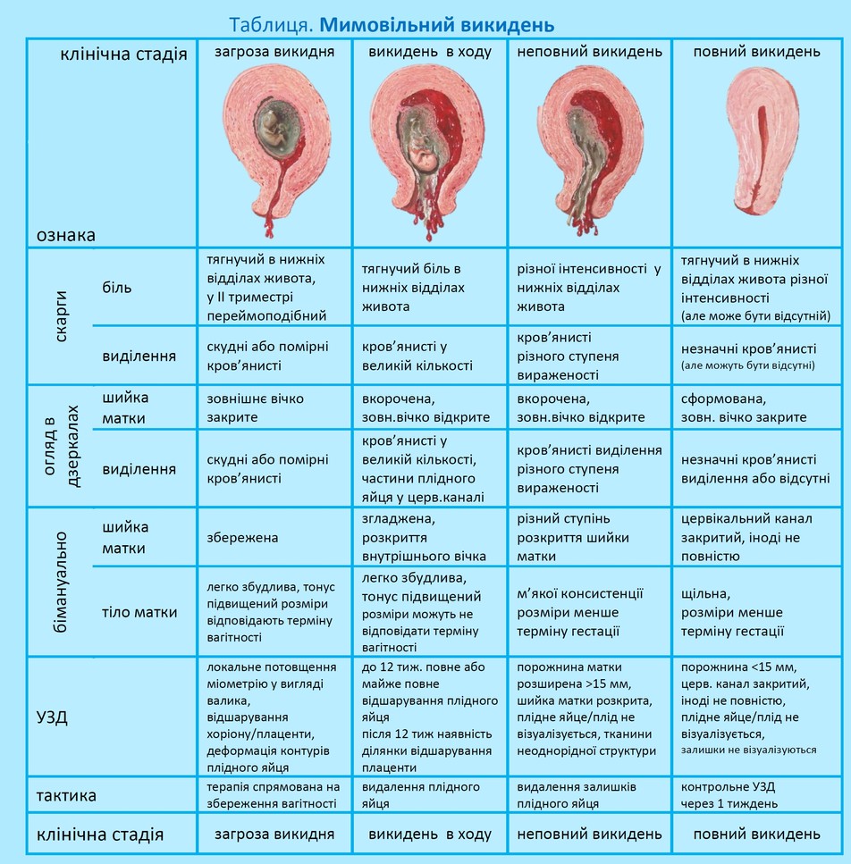 Невиношування вагітності - Акушерство для студентів І та ІІ рівнів ...