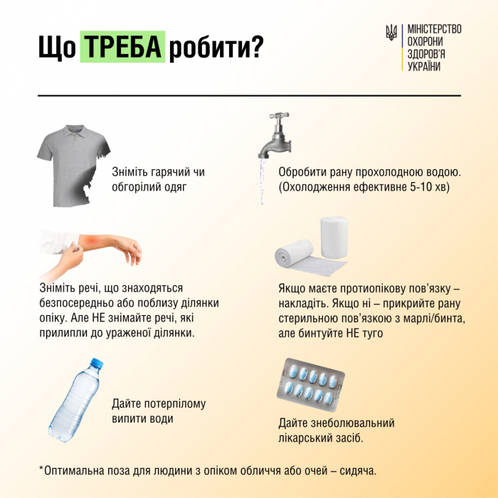 Що робити у разі опіків: п'ять порад від МОЗ, які повинен знати кожен