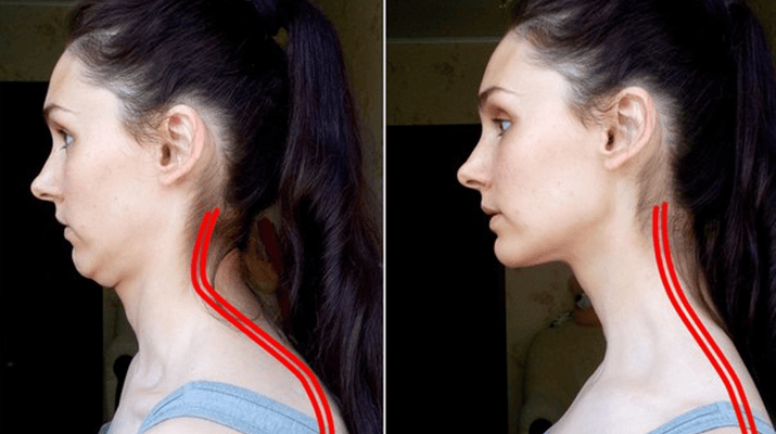 Що робити, якщо відчуваєте біль під нижньою щелепою: поради та причини