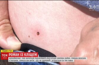 Що робити після укусу кліща: покрокова інструкція та поради експертів.