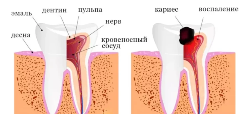 Скільки часу може боліти зуб після пломбування: що очікувати?
