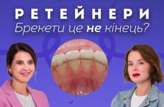 Скільки часу необхідно носити капу після зняття брекетів?