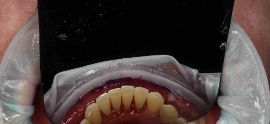 Скільки часу утримуватися від їжі після чистки зубів: поради стоматологів