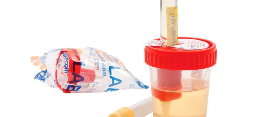 Скільки мілілітрів сечі потрібно здавати для аналізу: поради експертів