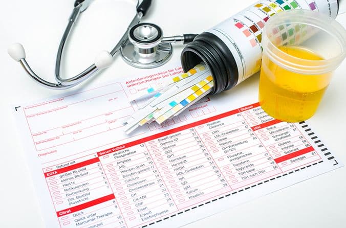 Аналізи сечі і калу - MdClinic