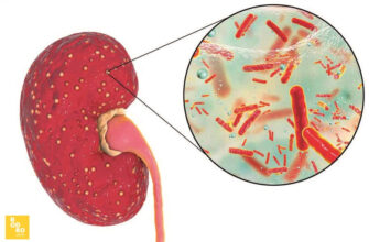 Симптоми та лікування болю в нирках: поради урологів