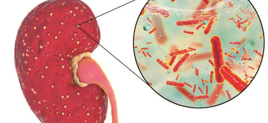 Симптоми та лікування болю в нирках: поради урологів