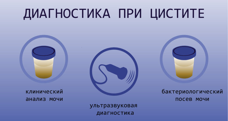 Цистит після статевого акту: обговорення та поради на форумі