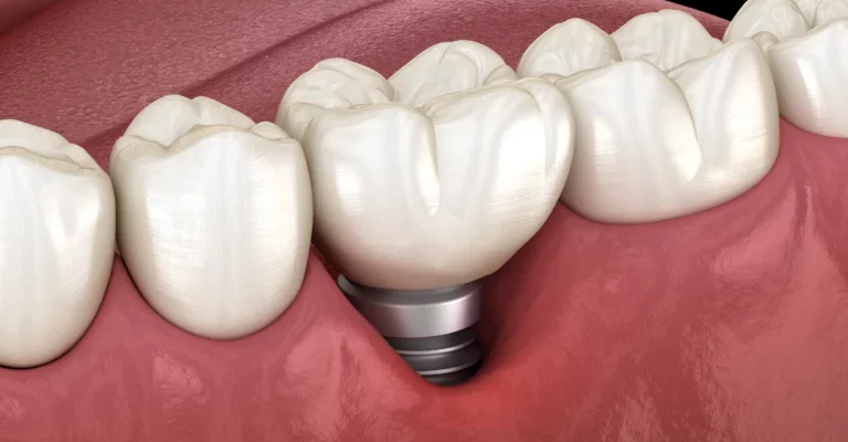 Ускладнення після імплантації кардіостимулятора: як їх уникнути