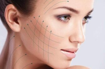 Ускладнення після ліфтингу нитками: що важливо знати перед процедурою