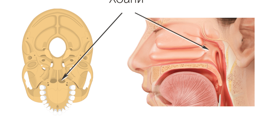 Ускладнення після видалення аденоїдів: діагностика та лікування
